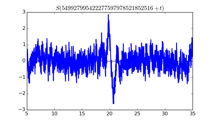 zeta function picture