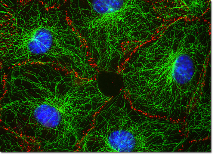 fibroblasts